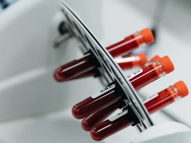 Laboratóriumi mintatartó állvány a patológiai részlegen